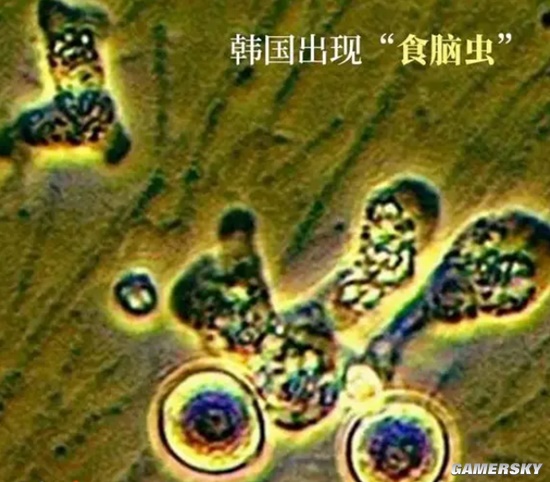 韩国报告首例“食脑虫”病例 一男子感染身亡