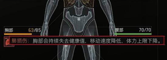 《暗區突圍無限》健康系統機制解讀 - 第14張