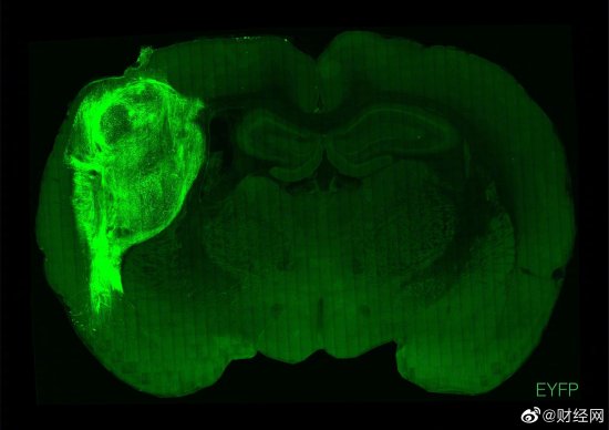 科学家将人脑器官植入老鼠大脑 结果很意外