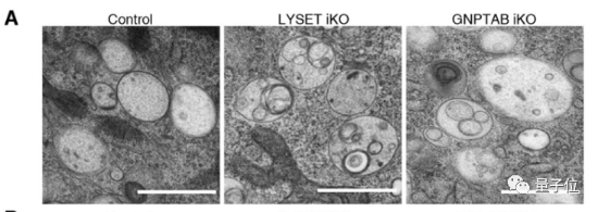 让癌细胞自己饿死自己？科学家找到治疗肿瘤新方法